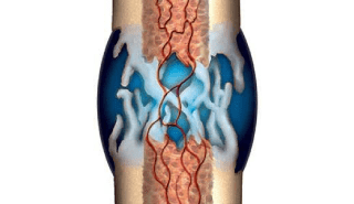 https://kneeclinic.ca/wp-content/uploads/2020/07/patient-about-exogen-section7-2.png