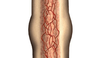 Bone Remodeling